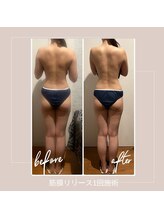 バンブー B2 新涯店(Bamboo)/筋膜リリース