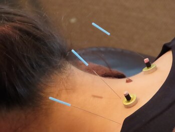 きわみ鍼灸整骨院 博多院/【博多駅】首肩の痛みに