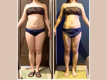 リライブ 亀有店(Re:Lives)/全身ビフォーアフター【痩身】