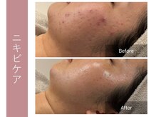 ジョルネ 中目黒(jornee.)/before/after