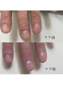 ハンドケア/ネイルケア