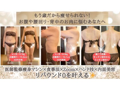 ウノジェンネ UNO DJENNEの写真