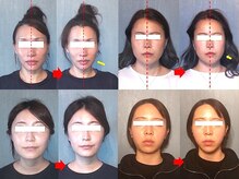 アトラスの雰囲気(顔の左右差を整えるには、“姿勢”がカギになります。)