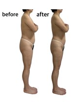 アンドエム(&M) 美骨 メソッド