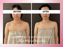 リス ブラン ビューティー(Lys blanc beauty)/９０分コルギBefore×After