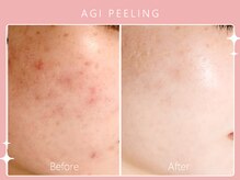 シロカネ イオンタウン西熊本店(SHIROKANE)/アギピーリング☆