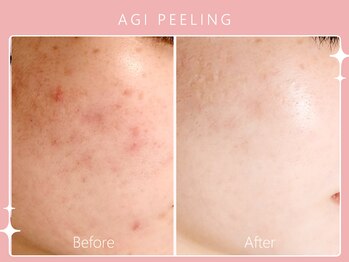 シロカネ イオンタウン西熊本店(SHIROKANE)/アギピーリング☆