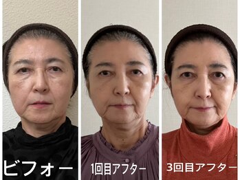 アクアナチュラ(ACQUANATURA)/息子さんの結婚式に向けて