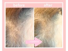 ピエルポゼ(Piereposer)/エクソソームで元気な毛髪に！