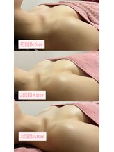 チュラ 大宮店(Chura)/【20代】バストアップ3回目@大宮