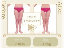 ピュアエステ ブリアント 松戸店/お客様の結果［松戸/痩身］