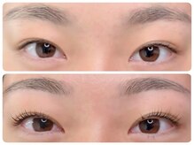 トータルビューティ ノイド(Noid)/パリジェンヌ＆眉WAX脱毛