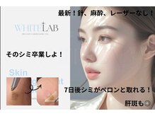 サロン リノ(salon rino)の雰囲気（ホワイトラボ◎シミ悩み、ここで終わり 7日で実感、60日で自信！）
