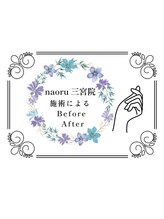 ナオル整体 三宮院(NAORU整体)/【三宮院】実際のBefore/After
