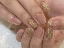 ミニョン(mignon)/Mignon定額コース