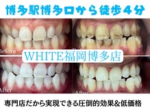 ホワイト 福岡博多店(WHITE)