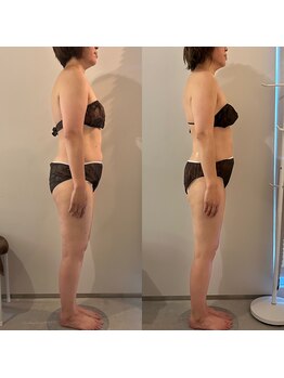 ラナ 京都西院店(Lana)/よもぎ蒸し＆リンパマッサージ