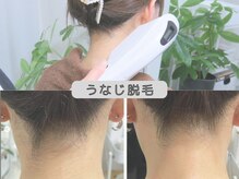 リタプレイス 琴似(LITAPLACE)の雰囲気（大人気うなじ脱毛オプション！♯脱毛＃ホワイトニング＃札幌）