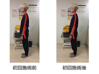 ストラボ 横浜店/ビフォーアフター５