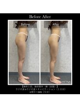 アルビ(ARuBi)/【美脚、ハリアップ】