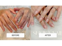 ツキカドットネイル(TSUKIKA.NAIL)の雰囲気（左 : 短く切り過ぎで丸くなっていた11ヶ月前 / 右 : 現在）