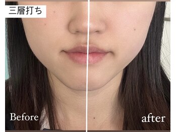 ライム 武蔵小杉(LIME)/自社痩身で即実感｜小顔ケア