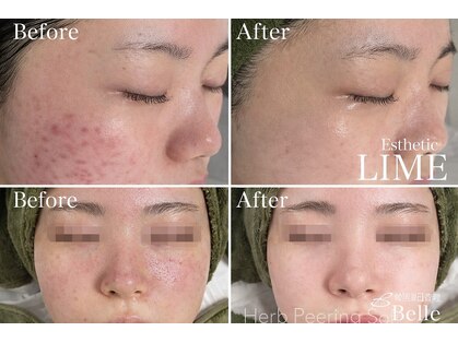 ベル 泉中央(Belle)の写真