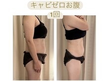ビボーン ボディ(美bone body)/ハイパーナイフ×キャビゼロ