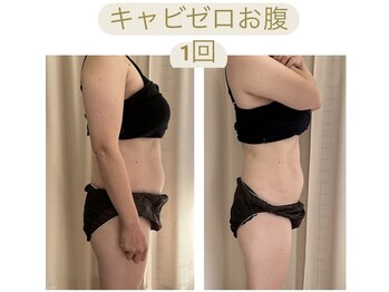 ビボーン ボディ(美bone body)/ハイパーナイフ×キャビゼロ
