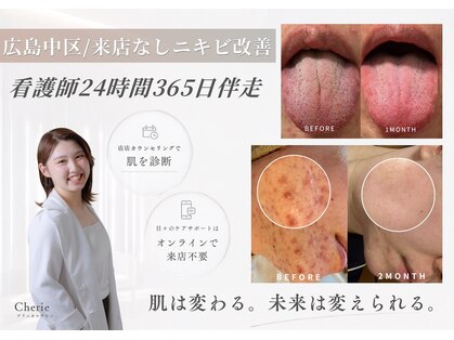 シェリー(Cherie)の写真