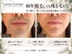 ルアナラウンジ(Luana Lounge)の写真
