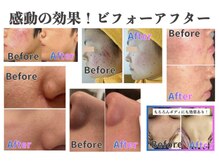 ヨロ 梅郷店(YOLO)/before⇒after