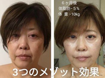 エクラ(Eclat)/小顔+肌質改善+たるみケア専門