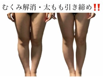 痩身革命 大宮店/ダイエットリンパマッサージ