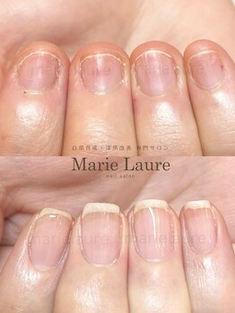 マリーロール 淀屋橋本店(Marie Laure)/自爪育成/深爪矯正/ネイルケア