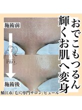 ピュール 鯖江店(PUR)/毛穴サロン/毛穴ケア/毛穴洗浄