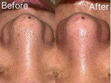 シェリーミル(Cherie Miru)/コモ×エクストラクション