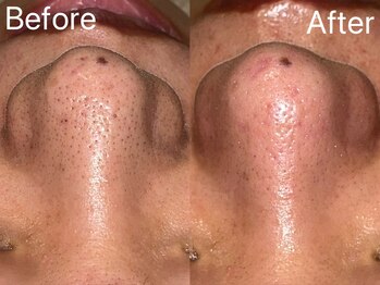 シェリーミル(Cherie Miru)/コモ×エクストラクション