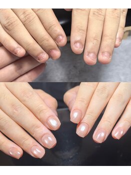 リリ(Rili)/深爪矯正，自爪育成