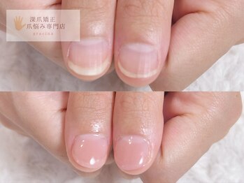 グラシナ なんば店/即日長さだしスキンカラー仕上げ