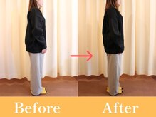 おひさま整骨院/ビフォー・アフター