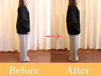 おひさま整骨院/ビフォー・アフター