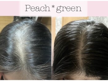 ピーチ グリーン(Peach green)の写真/《大人女性の髪悩みを解消！》頭皮からの本格ケア。心身の疲れを癒しながら未来の美髪を育みます。