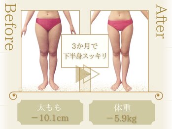 ピュアエステ ブリアント 松戸店/お客様の結果［松戸/痩身］