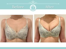 美人バスト 柏店/初回体験【バストアップ・育乳】