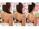 ビルーチェ(美LUCE)の写真/【運動なし-26kgの実績】猫背・巻き肩・反り腰根本調整！見た目/体重/体脂肪/体調/生理周期アドバイス付