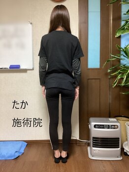 たか施術院/《美姿勢矯正》反り腰　骨盤矯正