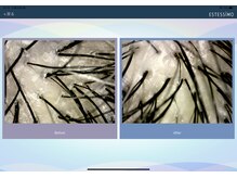 トウキ(TOUKI)/頭皮毛穴洗浄