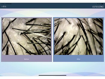 トウキ(TOUKI)/頭皮毛穴洗浄