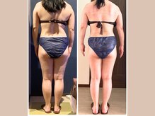 リライブ 亀有店(Re:Lives)/全身ビフォーアフター【痩身】